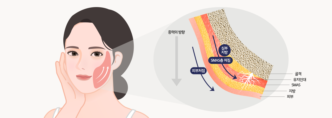 효과
