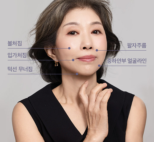 안면거상술 수술정보