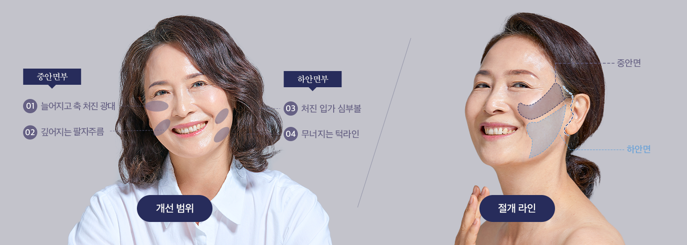 효과
