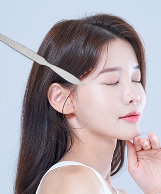중하안면 미니거상 STEP 1 이미지