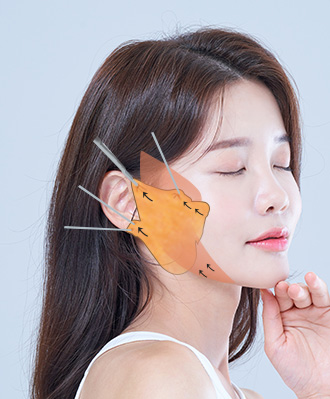 중하안면 미니거상 STEP 2 이미지