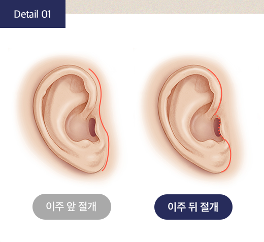 효과