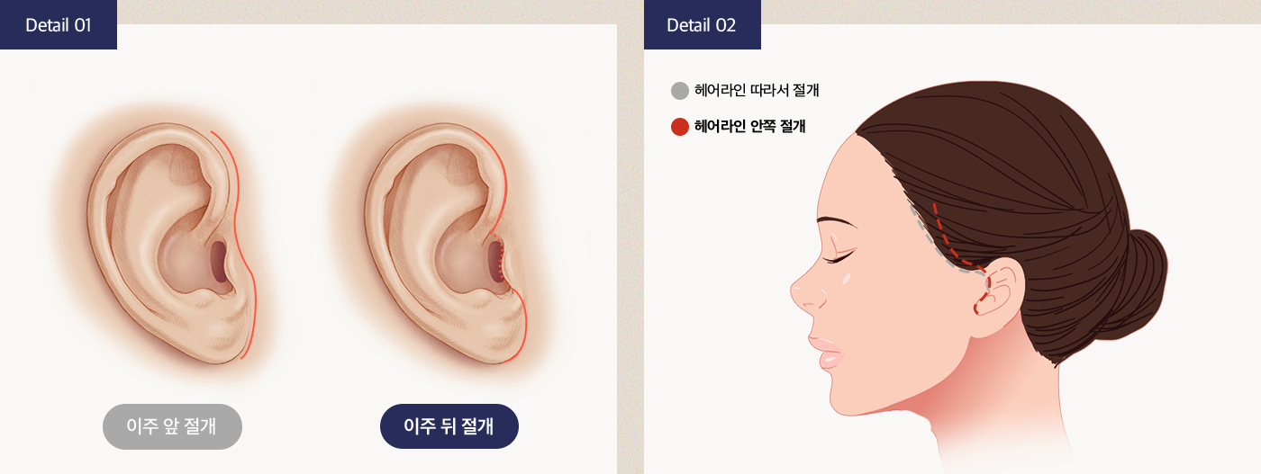 효과