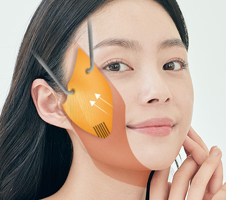 미니안면거상 STEP 3 이미지