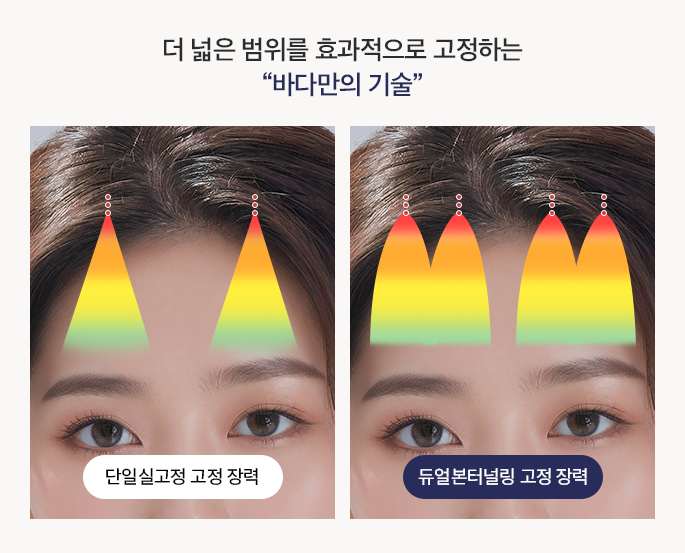 더 넓은 범위를 효과적으로 고정하는 바다만의 기술