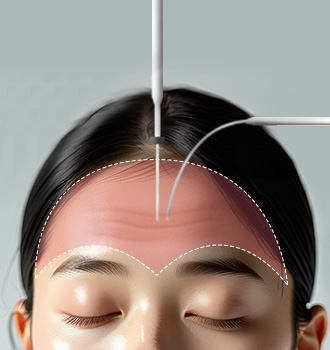 이마거상술 STEP 2 이미지