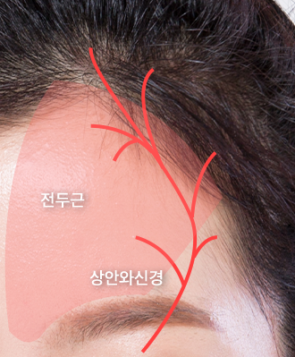 미니 리프팅 STEP 4 이미지